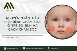 chàm sữa ở trẻ sơ sinh