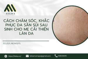 cach cham soc khac phuc da san sui sau sinh cho me cai thien lan da