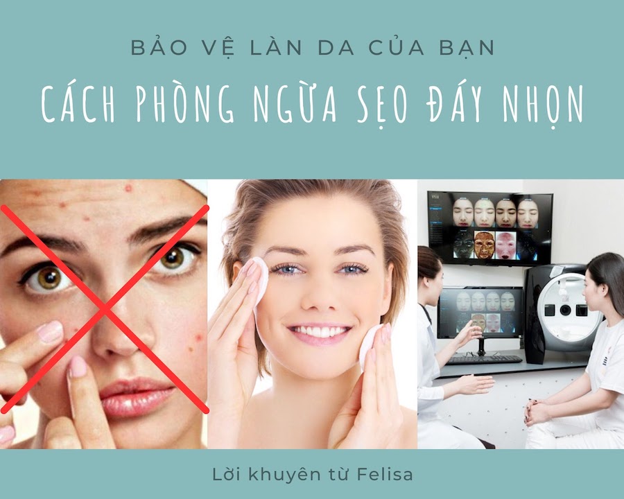 Ngừa sẹo đáy nhọn