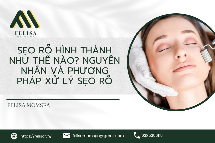 seo ro hinh thanh nhu the nao nguyen nhan va phuong phap xu ly seo ro