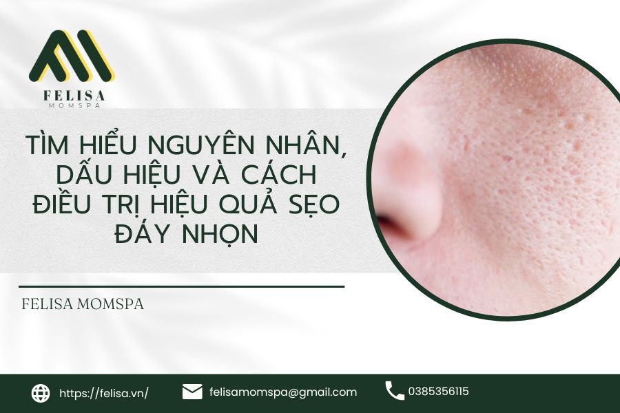 tim hieu nguyen nhan dau hieu va cach dieu tri hieu qua seo day nhon